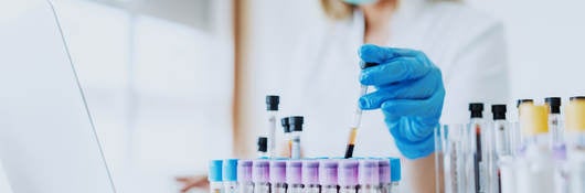 Laboratory technician working on laptop and handling test tubes